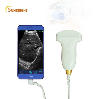 OB/GYN USB Convex Ultrasound Probe for Laptop and Smartphone 3d USB Ultrasound Probe Pocket Probe